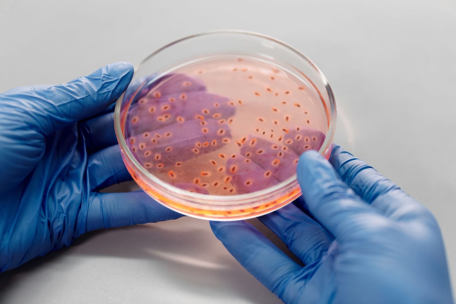 Nine-State Cyclospora Outbreak Tied to Taco Bell and Taylor Farms Now at 1,947 Confirmed Illnesses -- and Food Safety Lawyer Bill Marler Says There Is No Way to Wash the Parasite Off